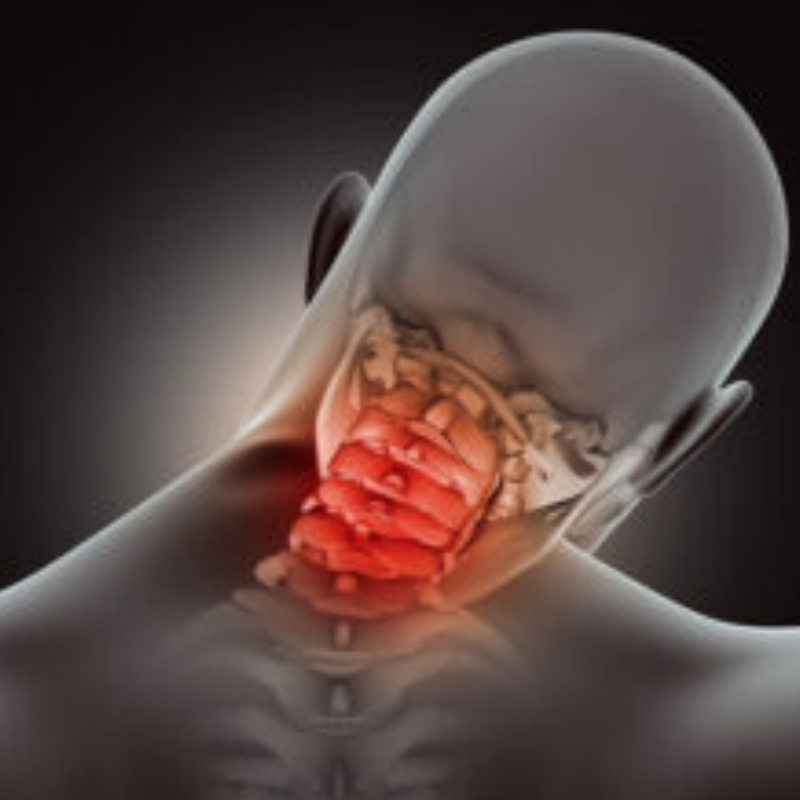 Cranio-vertebral Junction Anomalies